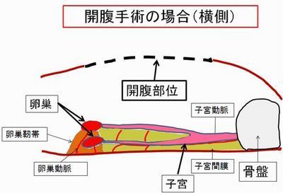 b02横面像　開腹ｓｐａｙ時.jpg