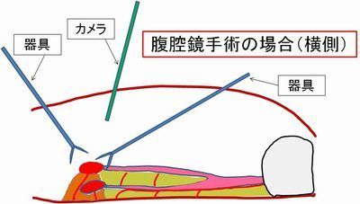 d03横面像　ﾗﾊﾟﾛｓｐａｙ時.jpg