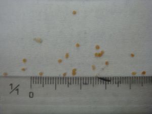 DSC04599 瓜実虫卵 乾燥.jpg