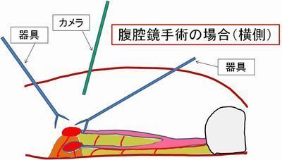 d03横面像　ﾗﾊﾟﾛｓｐａｙ時.jpg